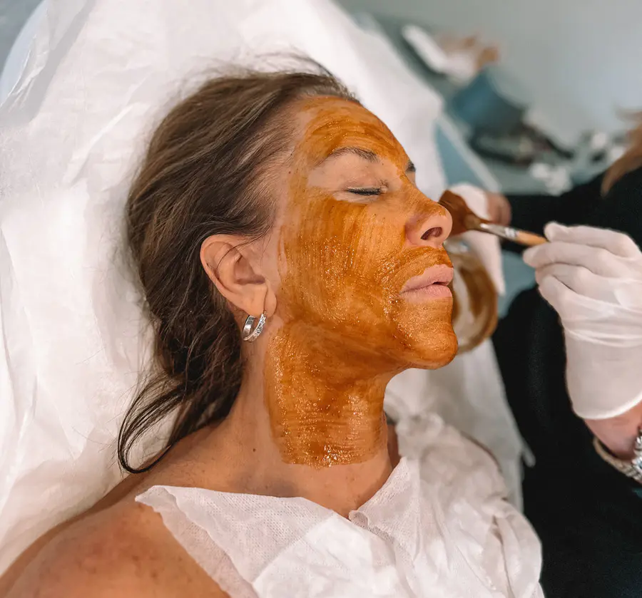 Patient receiving a chemical peel treatment on the face and neck at Refresh - Aesthetics & Wellness Patient receiving a chemical peel treatment on the face and neck at Refresh - Aesthetics & Wellness